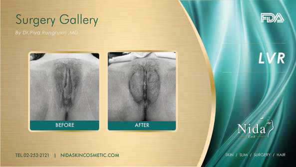 Nida Esthetic Cosmetic Surgery Bangkok