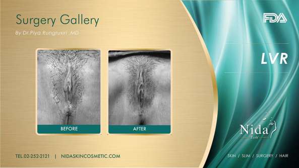 Nida Esthetic Cosmetic Surgery Bangkok