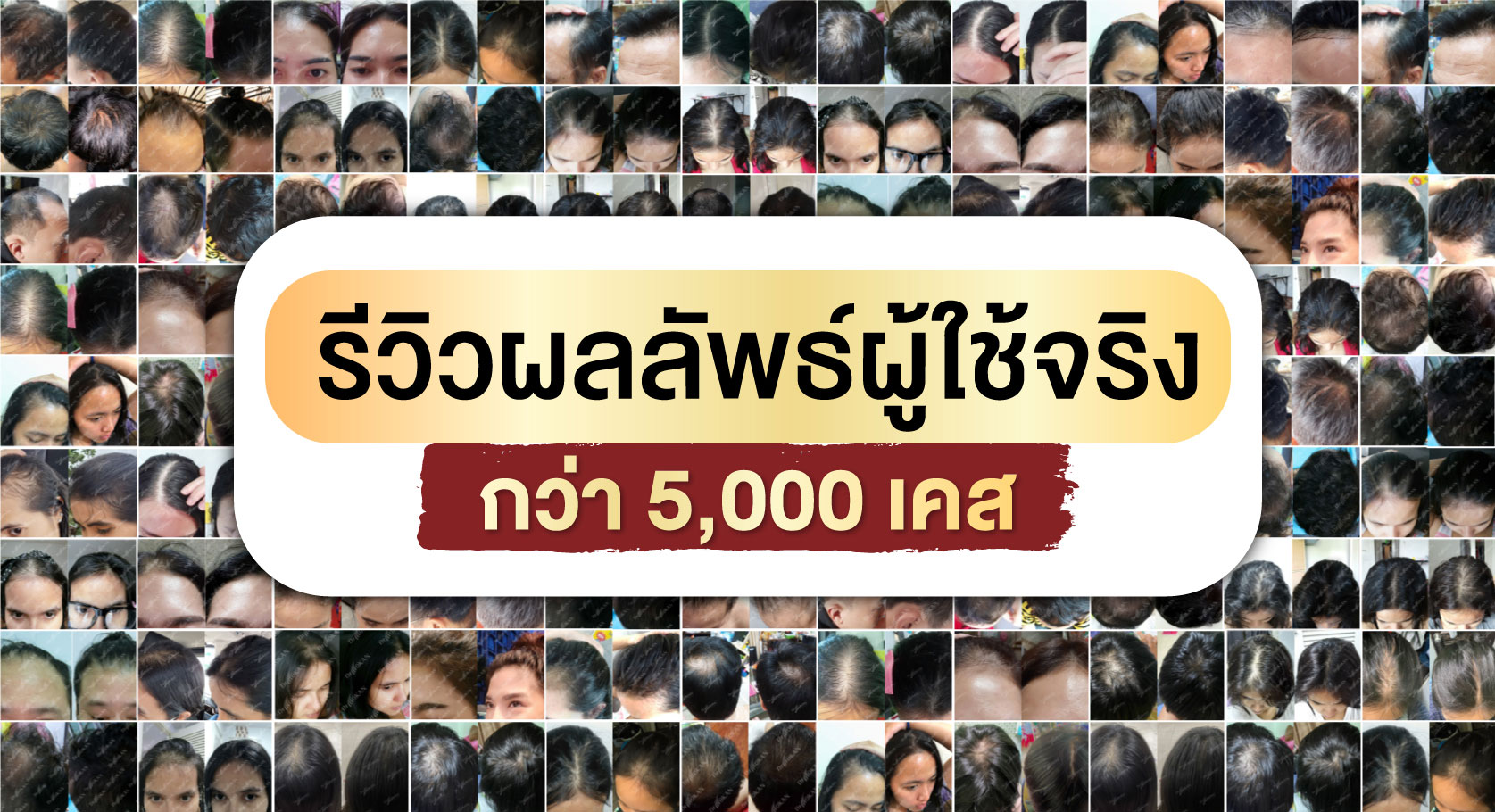 รีวิวผลลัพธ์จากผู้ใช้เซรั่มลดผมร่วงกว่า 5,000 เคส