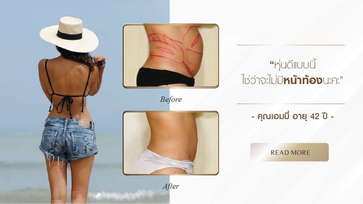 Nida Esthetic Cosmetic Surgery Bangkok