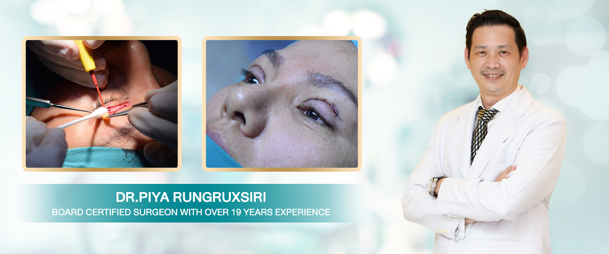 Nida Esthetic Cosmetic Surgery Bangkok