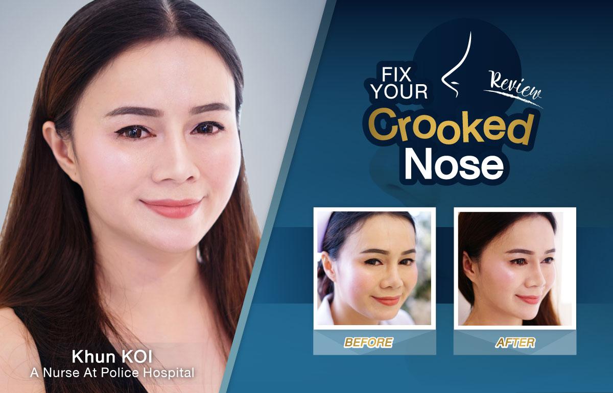 Nida Esthetic Cosmetic Surgery Bangkok