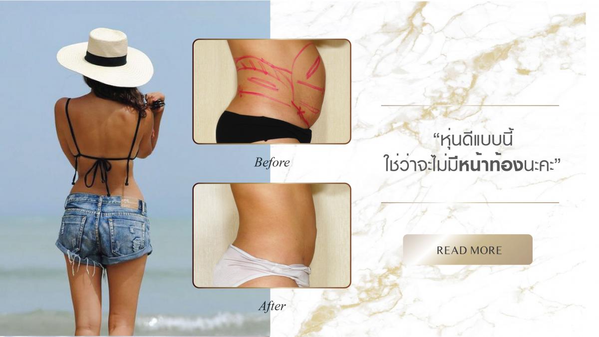 Nida Esthetic Cosmetic Surgery Bangkok