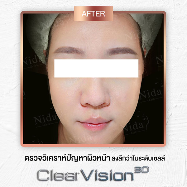 Nida Esth' ศูนยบริการทางการแพทย์ด้านความงาม แบบครบวงจร