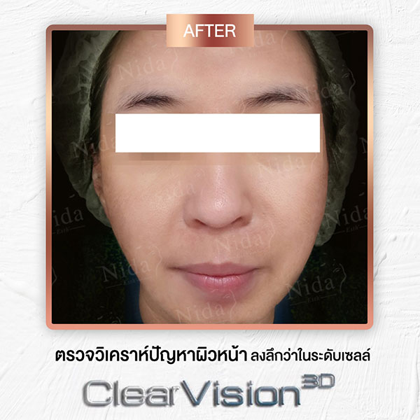 Nida Esth' ศูนยบริการทางการแพทย์ด้านความงาม แบบครบวงจร