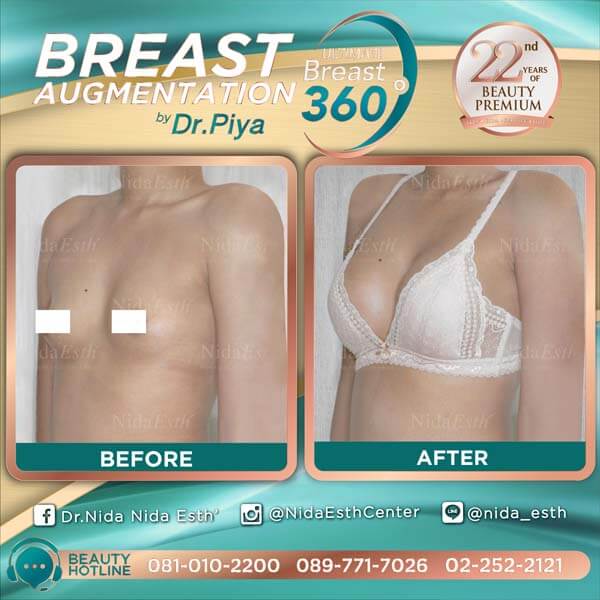 Nida Esth' ศูนยบริการทางการแพทย์ด้านความงาม แบบครบวงจร