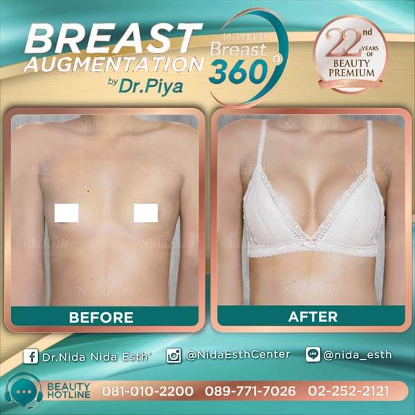 Nida Esth' ศูนยบริการทางการแพทย์ด้านความงาม แบบครบวงจร