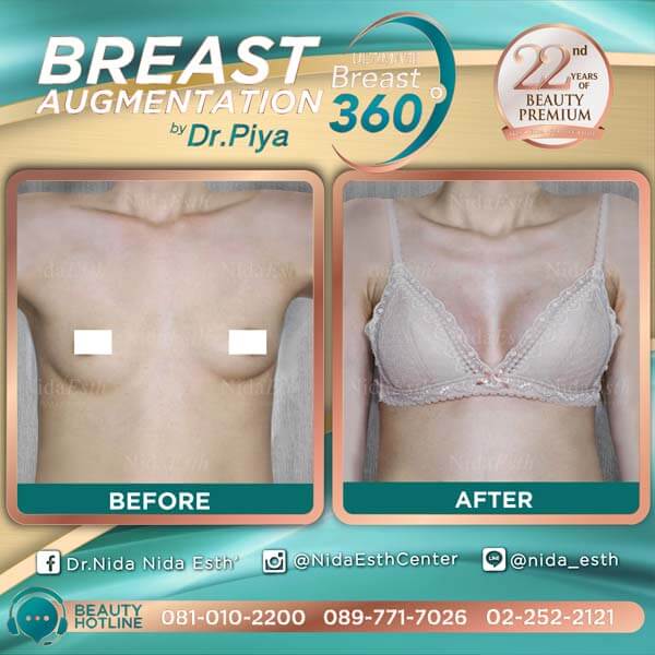 Nida Esth' ศูนยบริการทางการแพทย์ด้านความงาม แบบครบวงจร