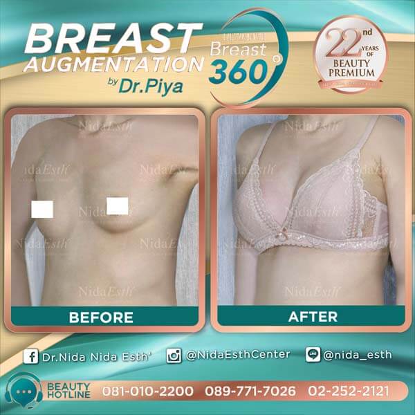Nida Esth' ศูนยบริการทางการแพทย์ด้านความงาม แบบครบวงจร