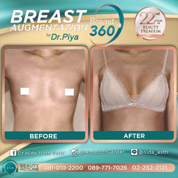 Nida Esth' ศูนยบริการทางการแพทย์ด้านความงาม แบบครบวงจร