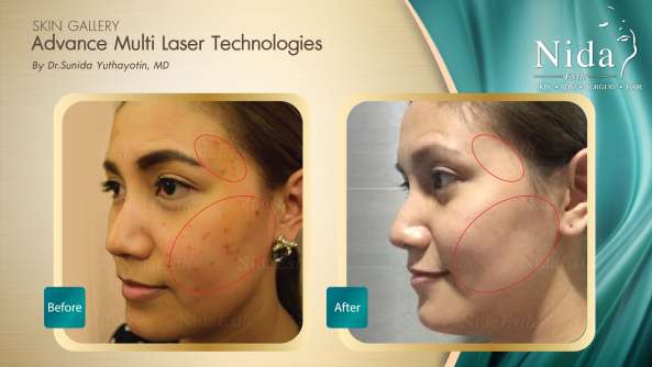 Nida Esthetic Cosmetic Surgery Bangkok