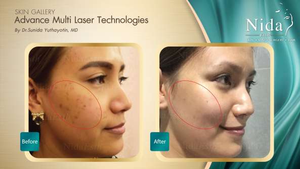 Nida Esthetic Cosmetic Surgery Bangkok