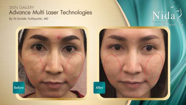 Nida Esthetic Cosmetic Surgery Bangkok