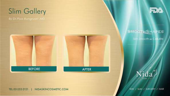 Nida Esthetic Cosmetic Surgery Bangkok