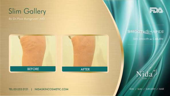 Nida Esthetic Cosmetic Surgery Bangkok