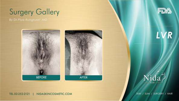 Nida Esthetic Cosmetic Surgery Bangkok