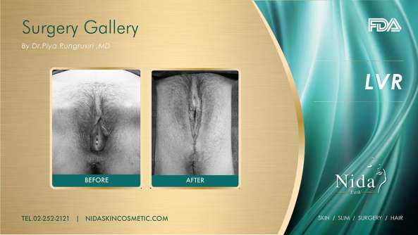 Nida Esthetic Cosmetic Surgery Bangkok