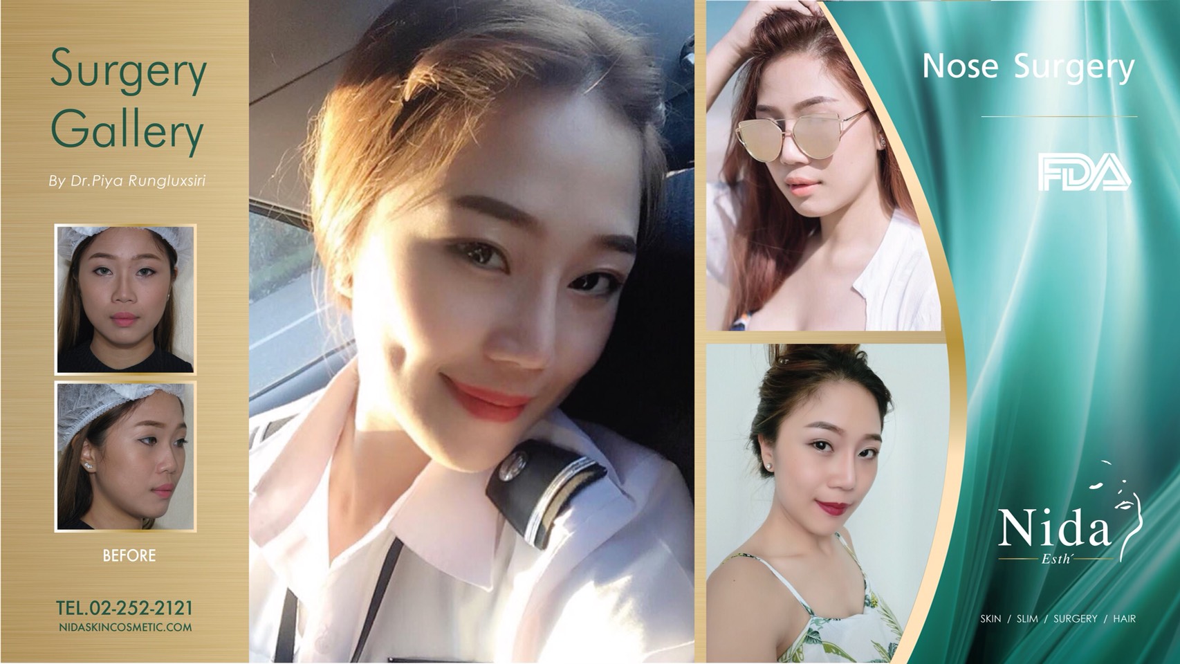 Nida Esthetic Cosmetic Surgery Bangkok