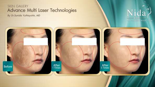 Nida Esthetic Cosmetic Surgery Bangkok