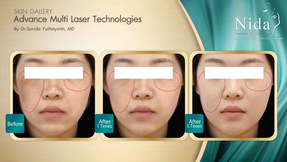 Nida Esthetic Cosmetic Surgery Bangkok