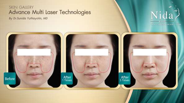 Nida Esthetic Cosmetic Surgery Bangkok