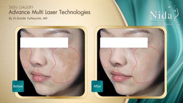 Nida Esthetic Cosmetic Surgery Bangkok