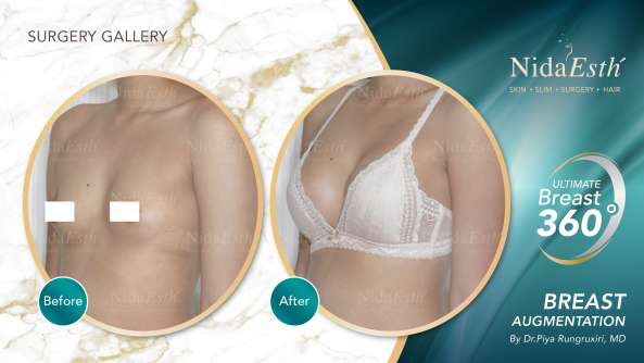 Nida Esthetic Cosmetic Surgery Bangkok