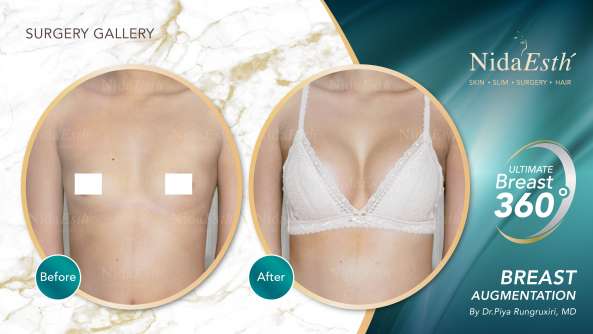 Nida Esthetic Cosmetic Surgery Bangkok