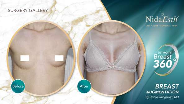 Nida Esthetic Cosmetic Surgery Bangkok