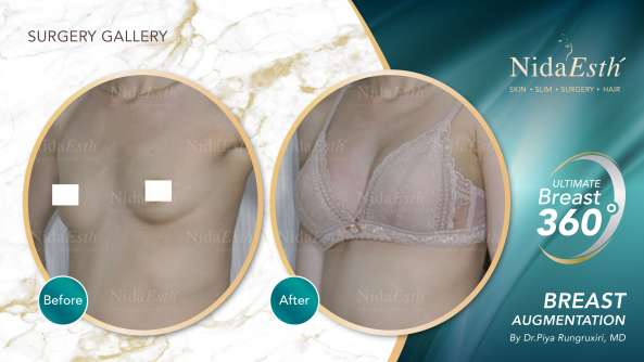 Nida Esthetic Cosmetic Surgery Bangkok