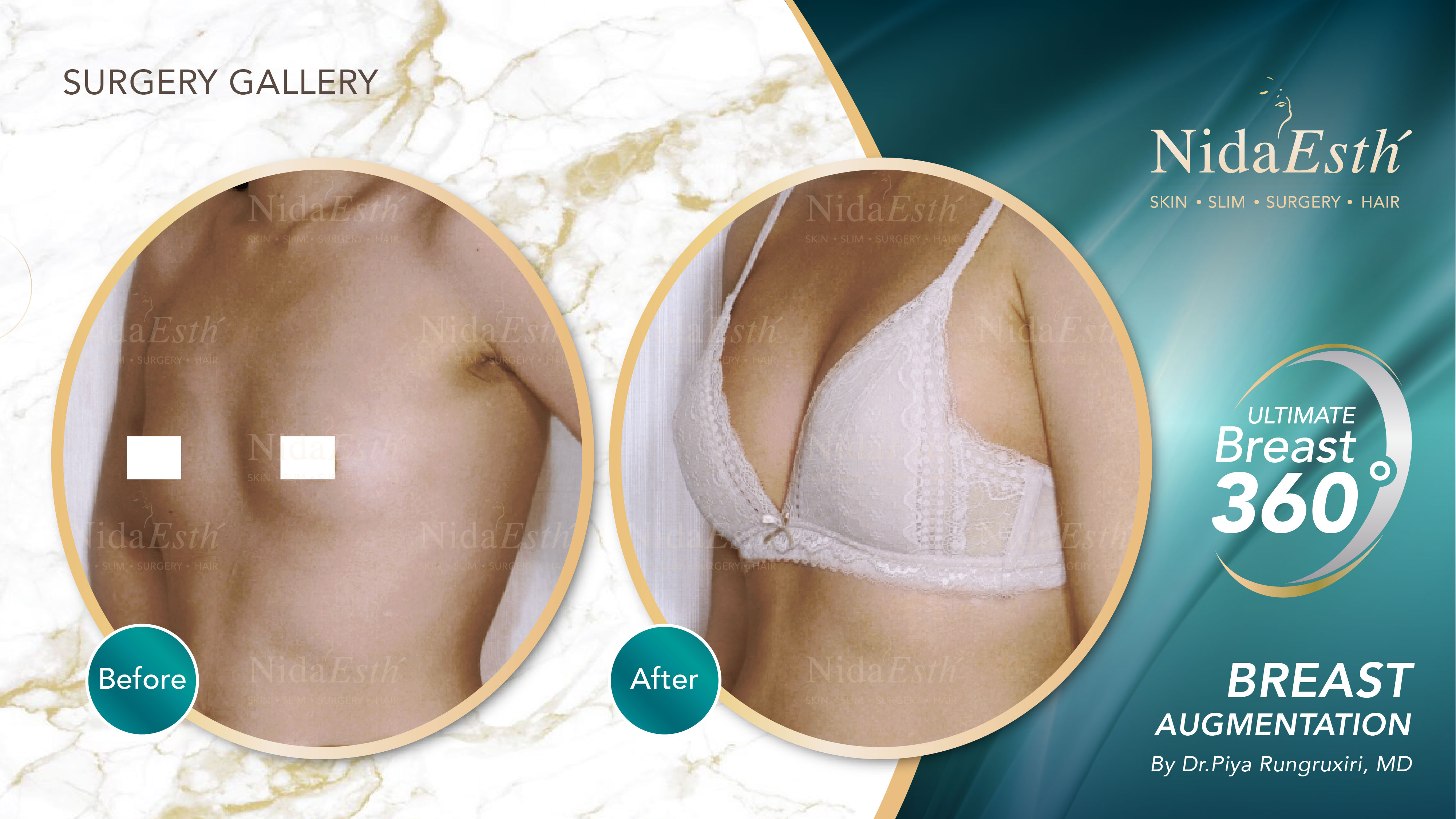 Nida Esthetic Cosmetic Surgery Bangkok