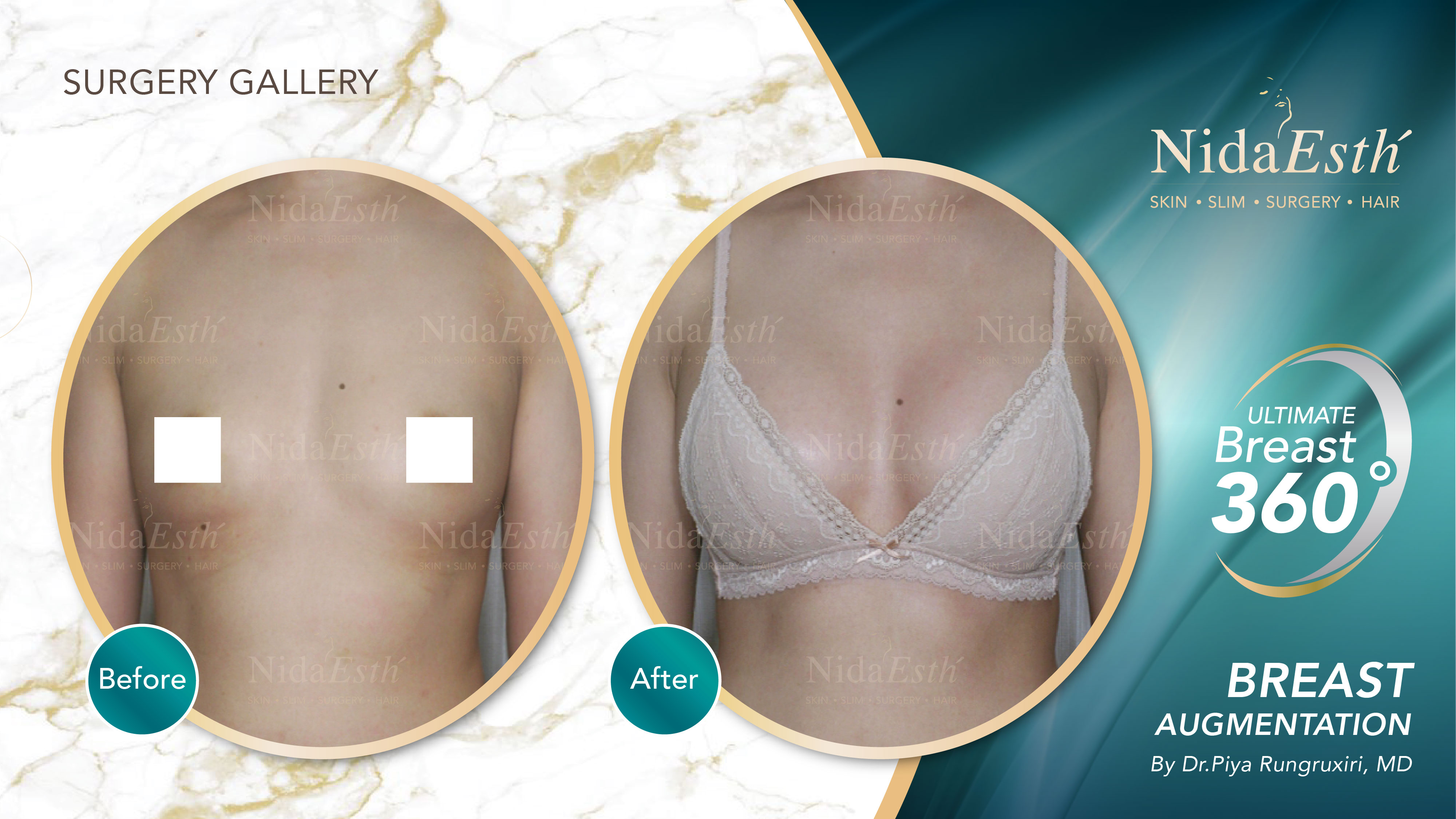 Nida Esthetic Cosmetic Surgery Bangkok