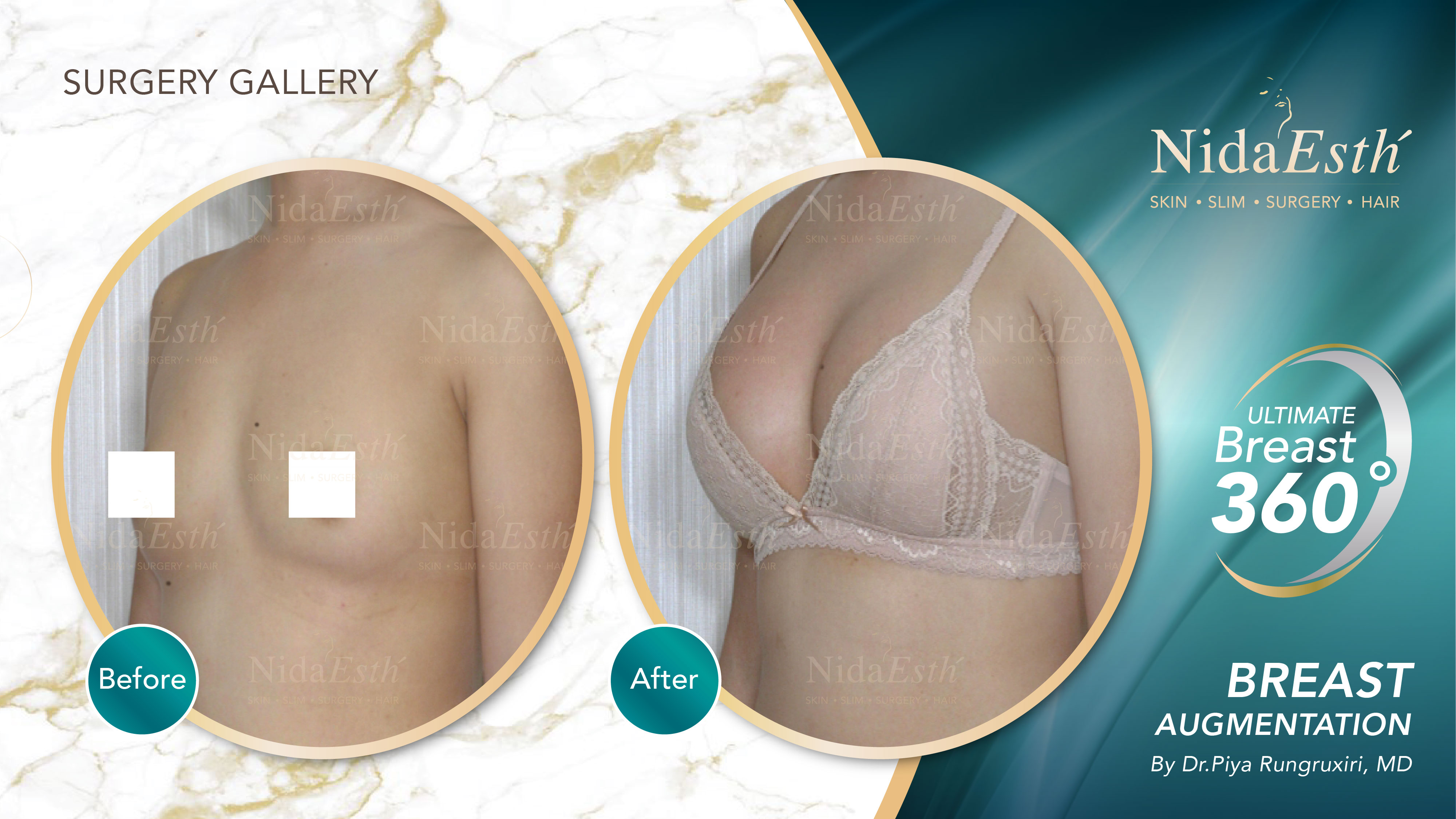 Nida Esthetic Cosmetic Surgery Bangkok