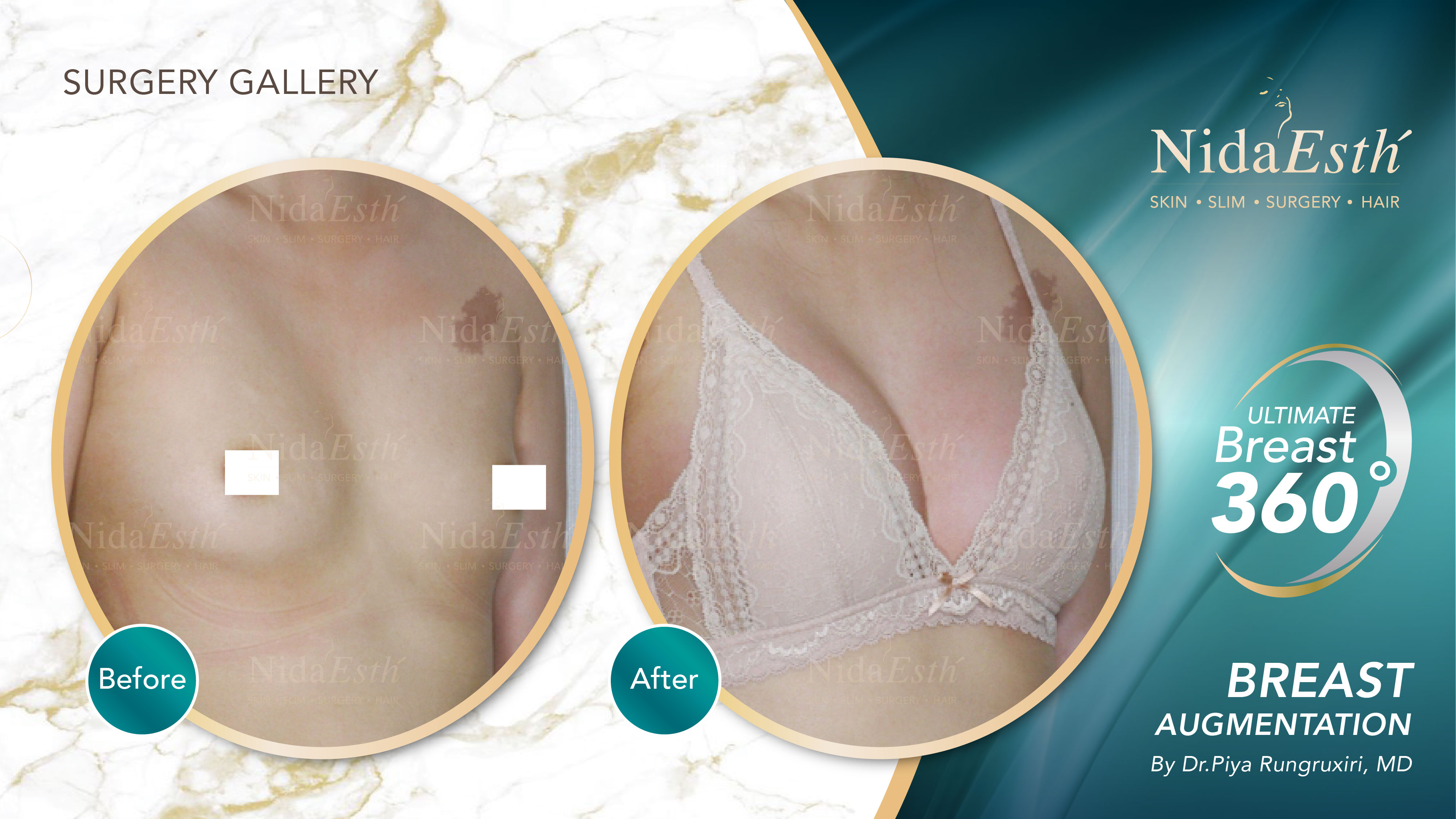 Nida Esthetic Cosmetic Surgery Bangkok