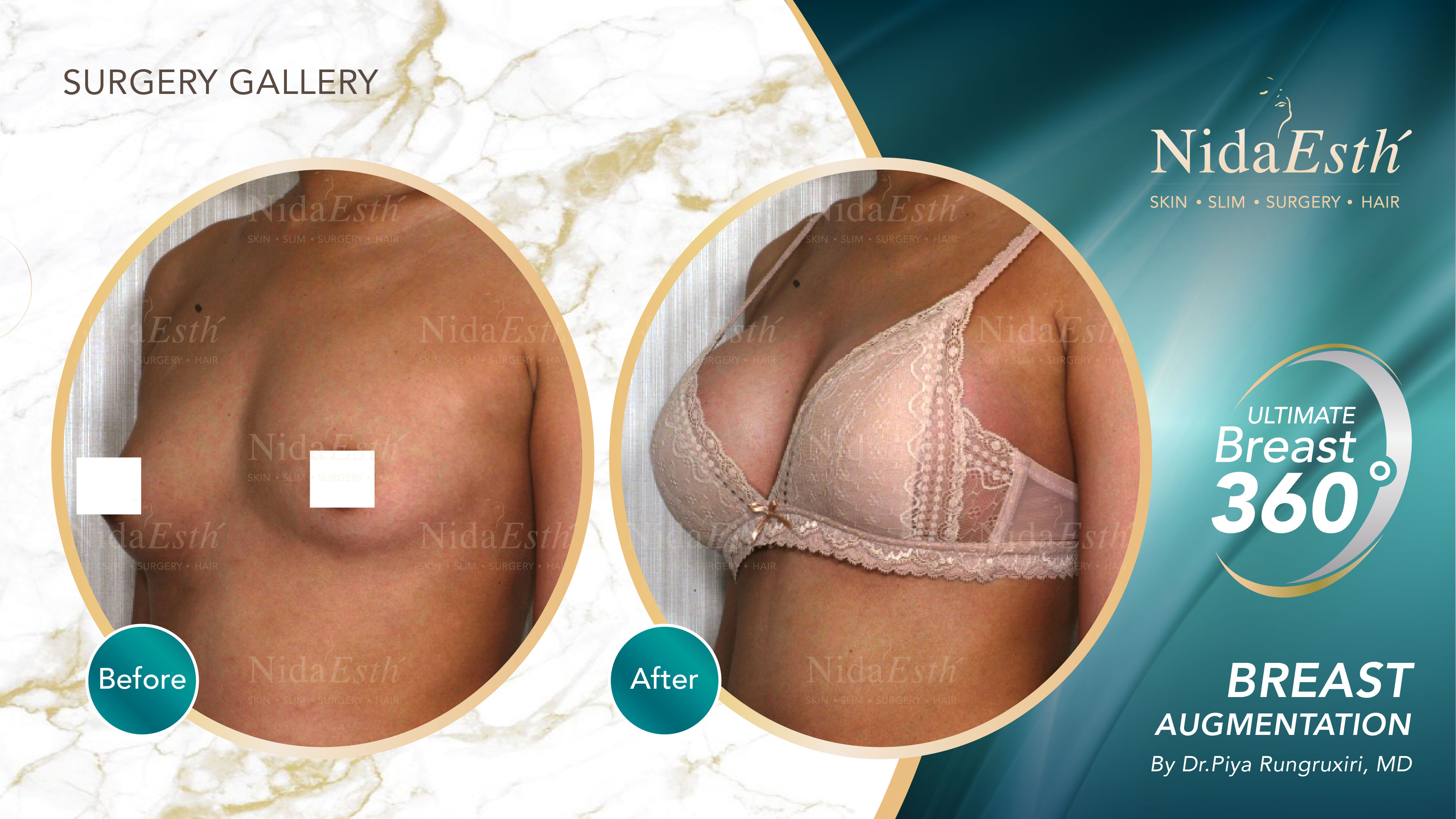 Nida Esthetic Cosmetic Surgery Bangkok