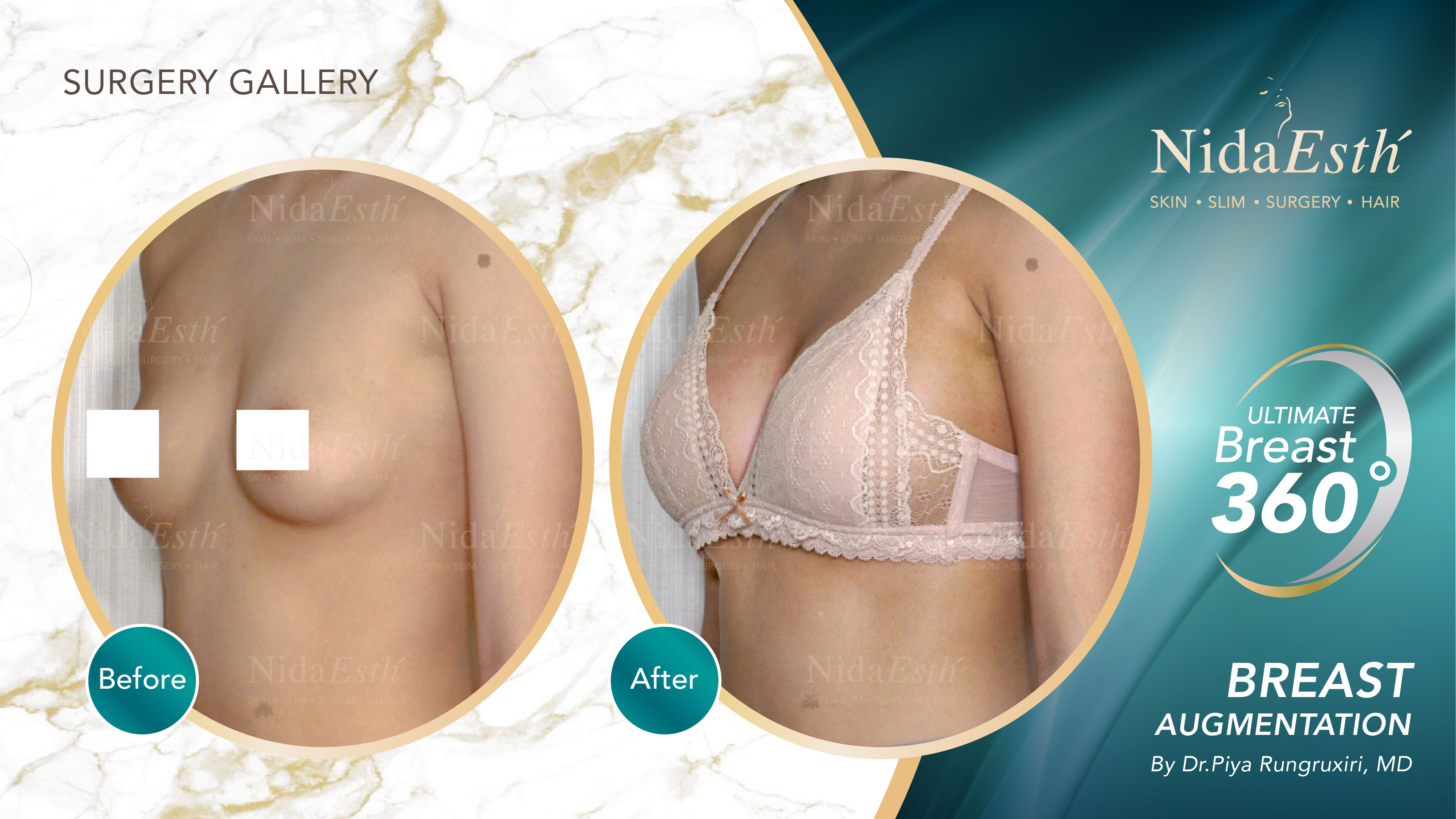 Nida Esthetic Cosmetic Surgery Bangkok