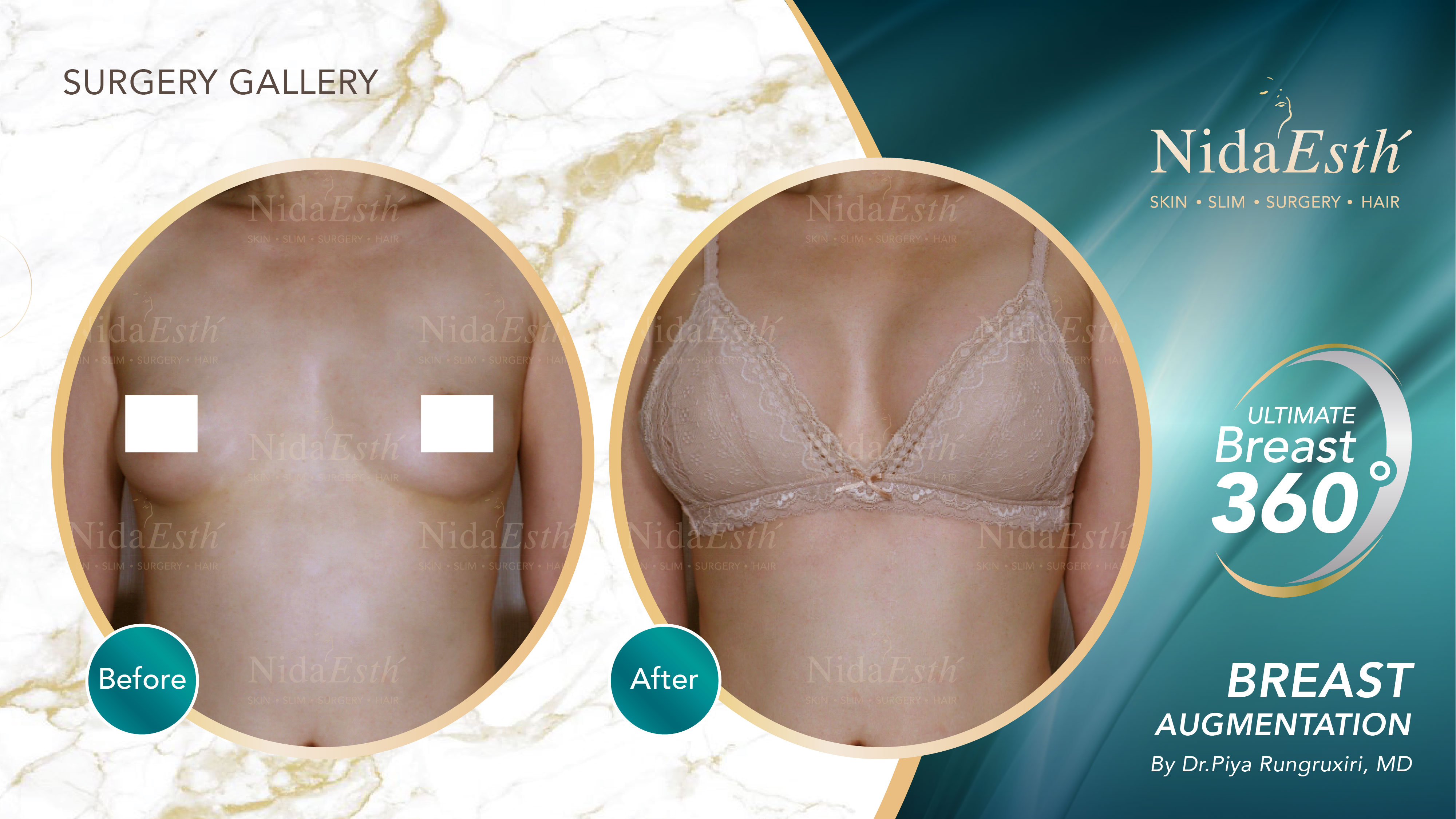 Nida Esthetic Cosmetic Surgery Bangkok