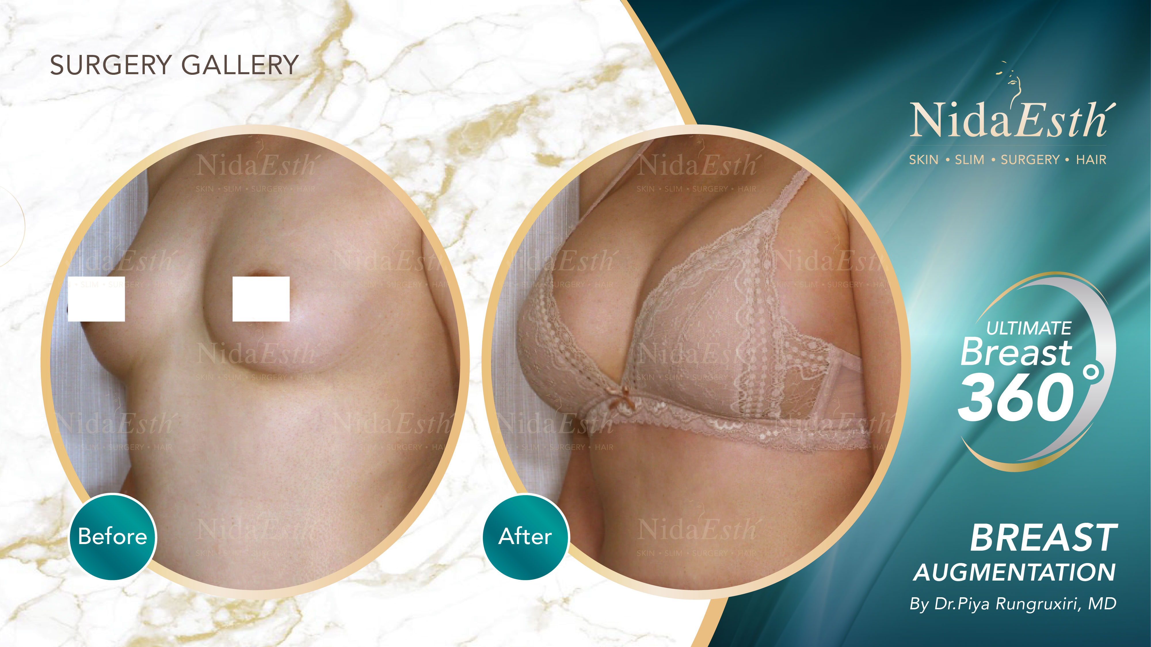 Nida Esthetic Cosmetic Surgery Bangkok