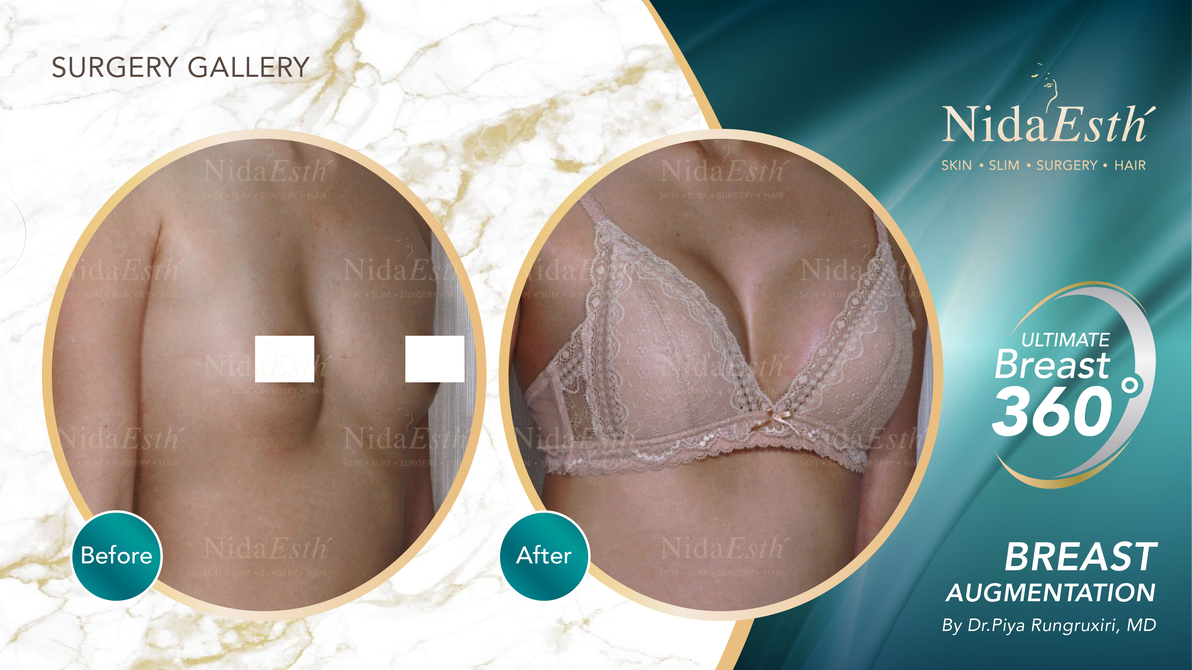 Nida Esthetic Cosmetic Surgery Bangkok