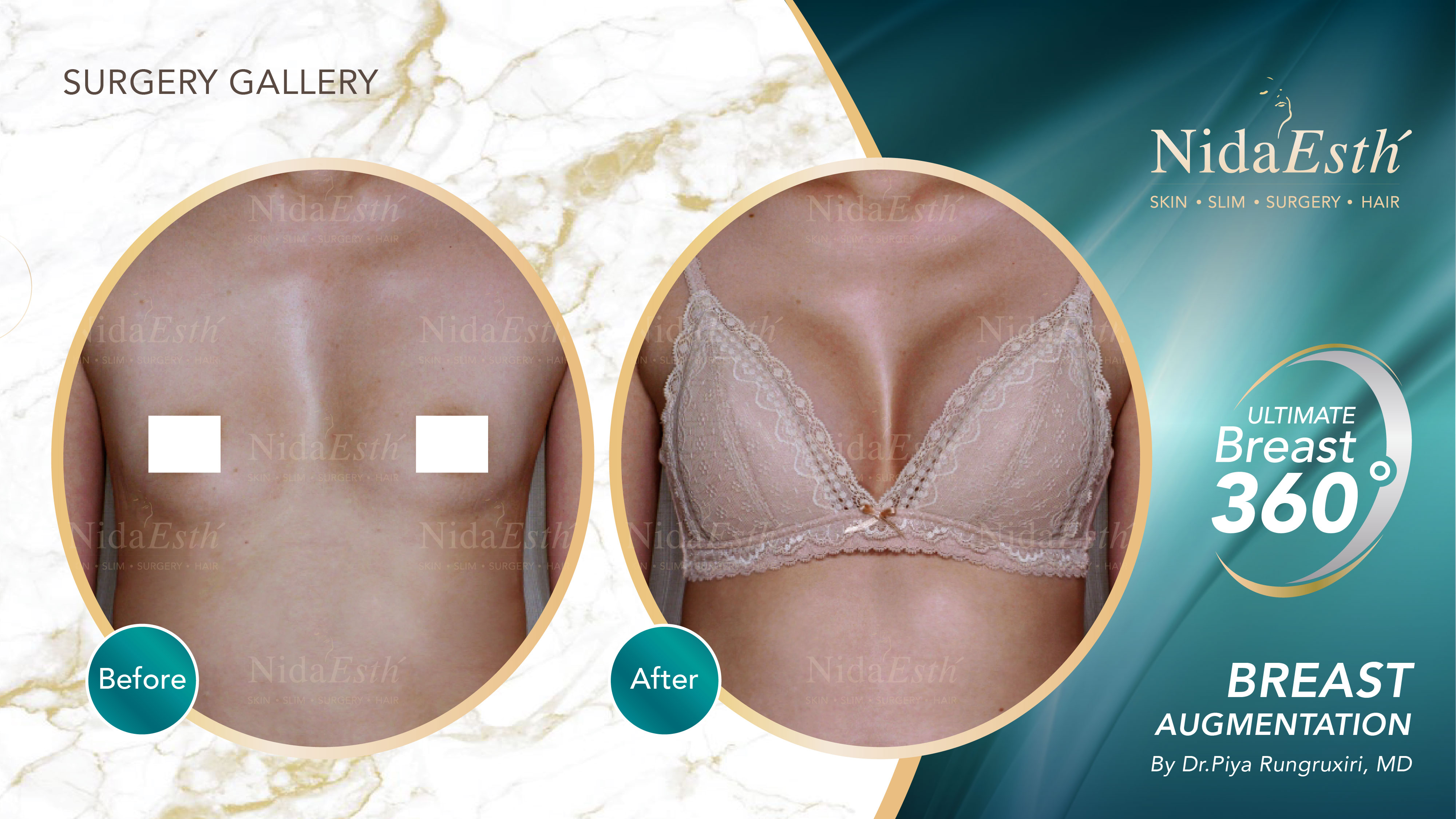 Nida Esthetic Cosmetic Surgery Bangkok