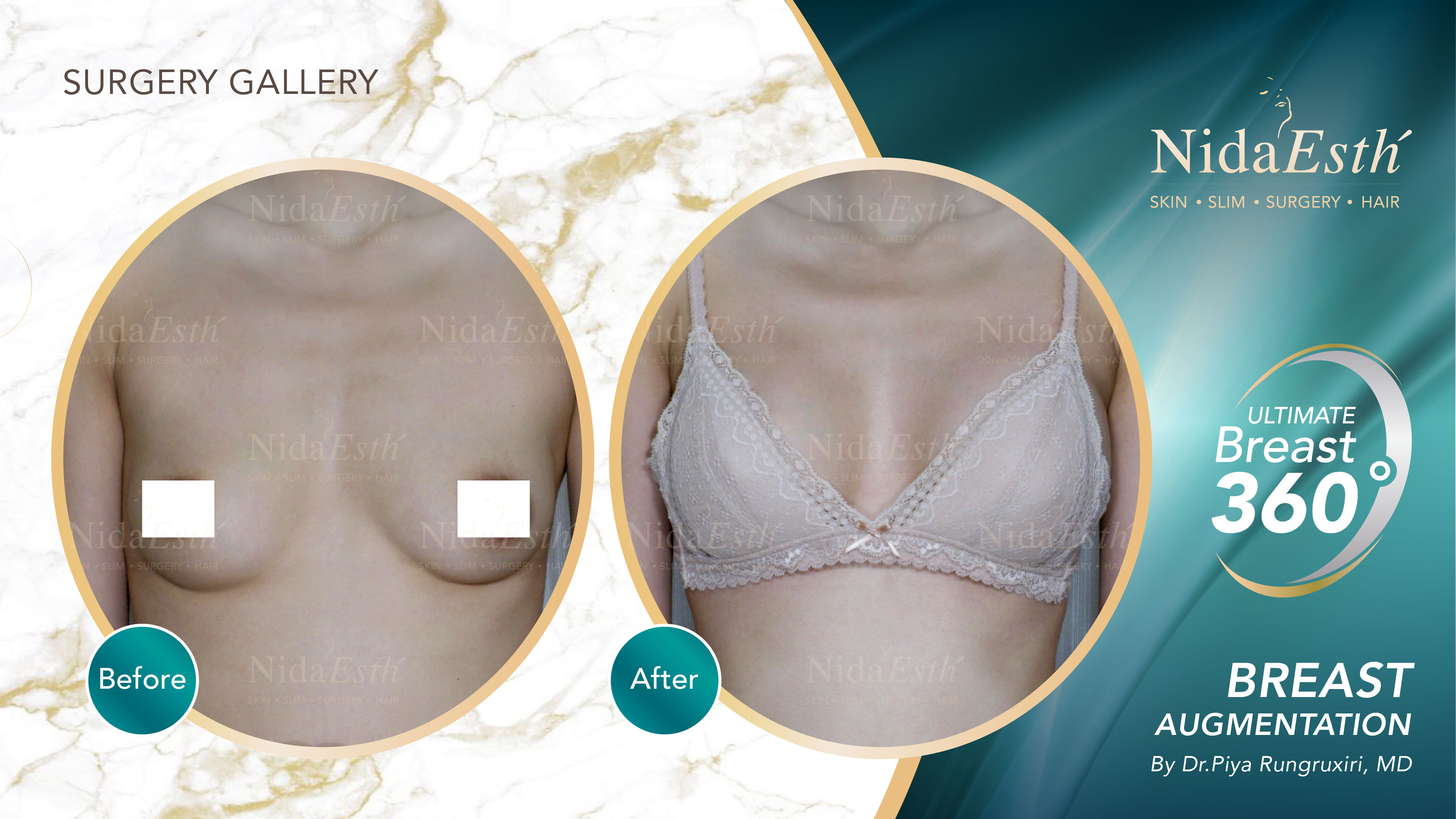 Nida Esthetic Cosmetic Surgery Bangkok