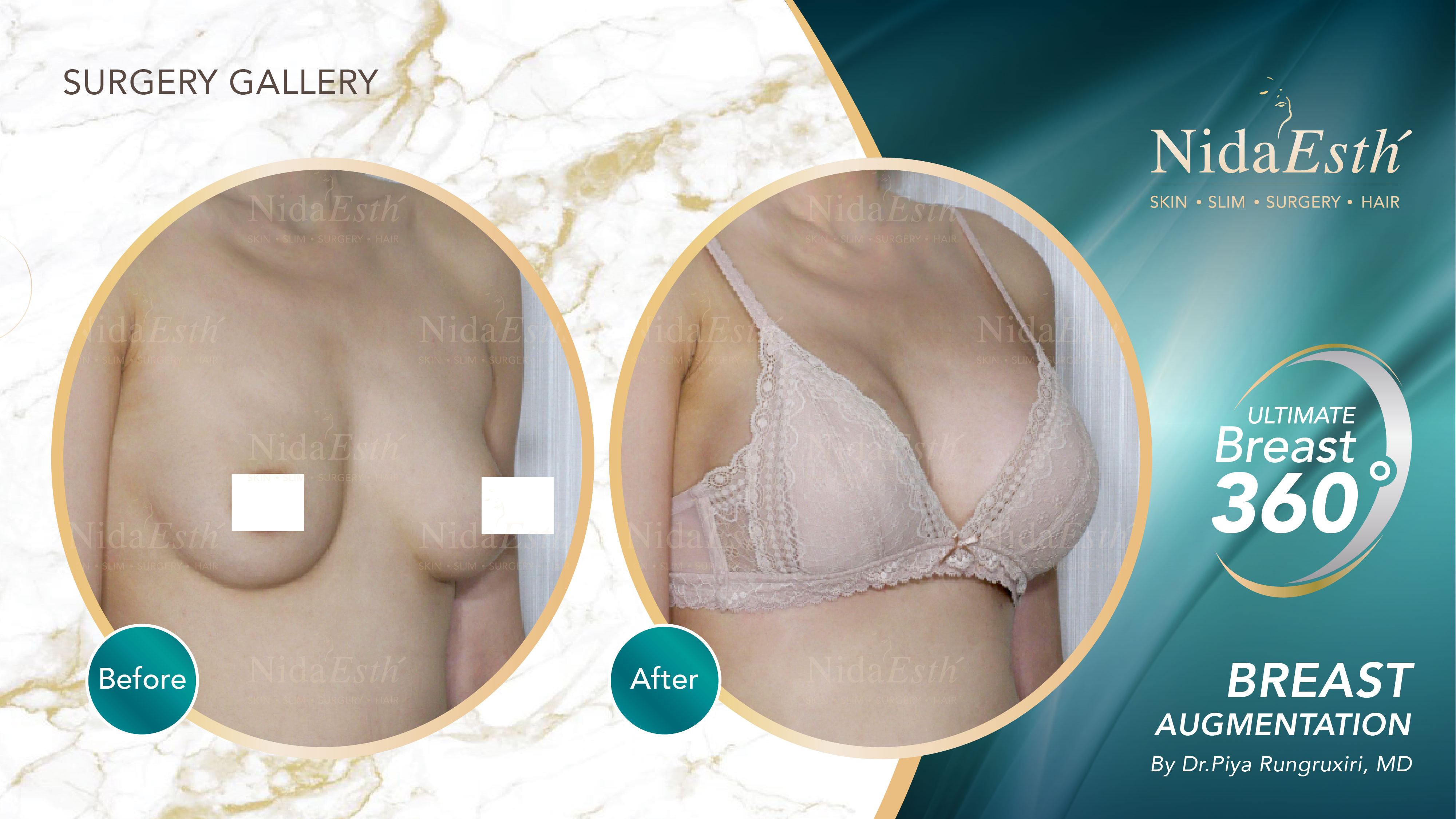 Nida Esthetic Cosmetic Surgery Bangkok