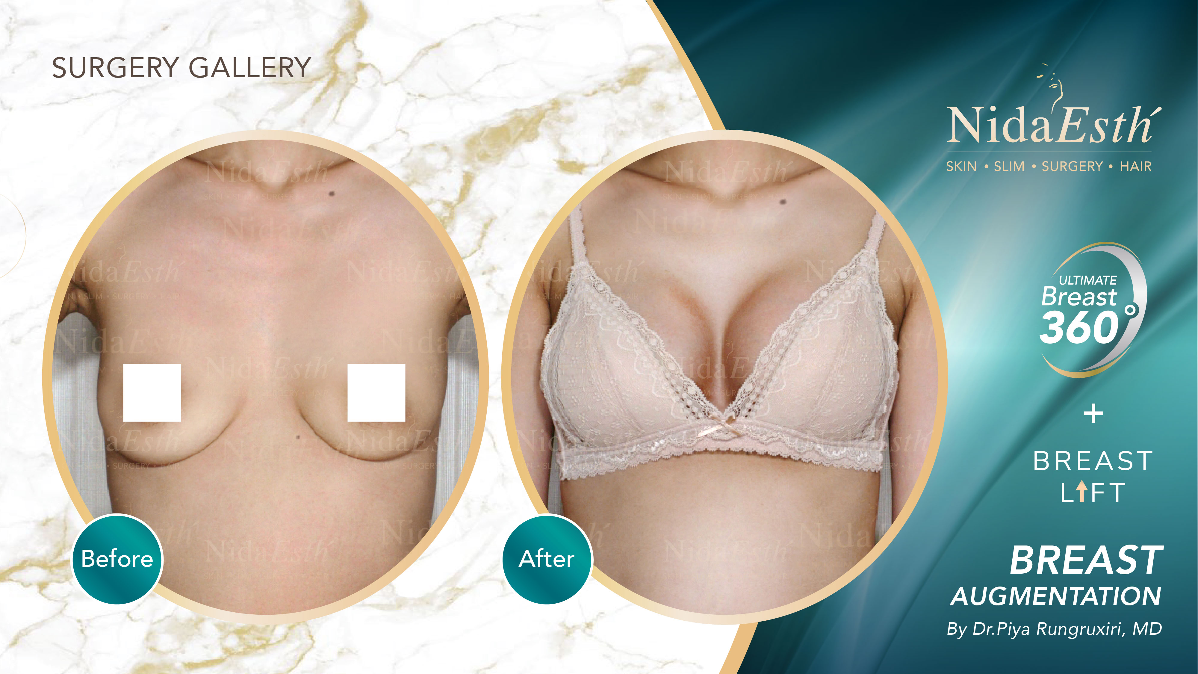 Nida Esthetic Cosmetic Surgery Bangkok