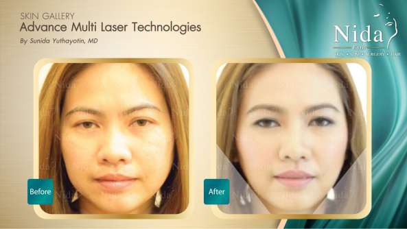 Nida Esthetic Cosmetic Surgery Bangkok