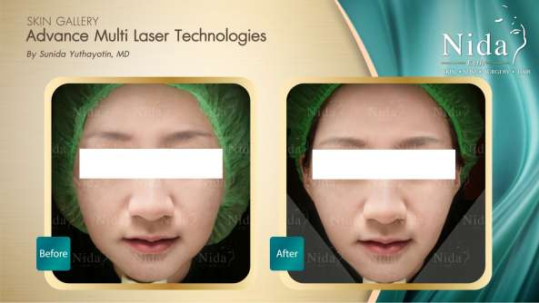 Nida Esthetic Cosmetic Surgery Bangkok