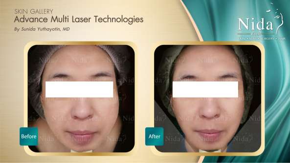 Nida Esthetic Cosmetic Surgery Bangkok