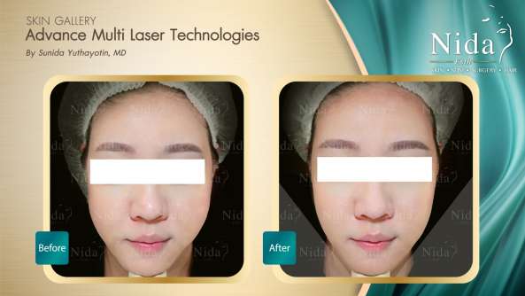 Nida Esthetic Cosmetic Surgery Bangkok