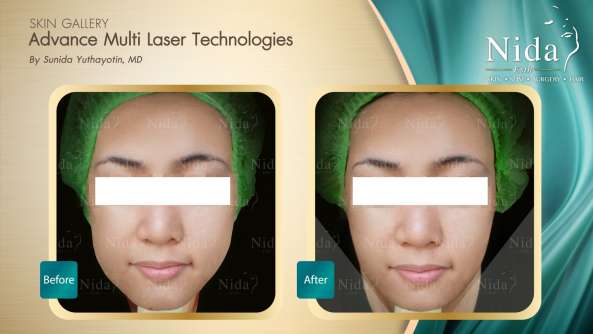 Nida Esthetic Cosmetic Surgery Bangkok