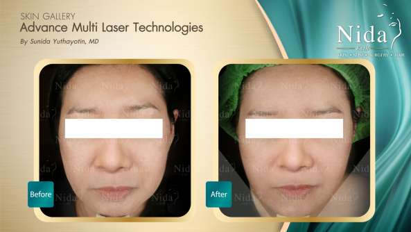 Nida Esthetic Cosmetic Surgery Bangkok