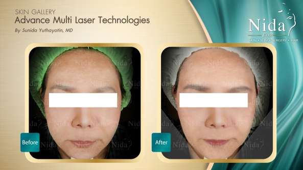 Nida Esthetic Cosmetic Surgery Bangkok